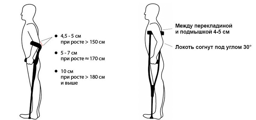 Костыли подмышечные алюминиенвые подростковые КАП-02ТМ УПС